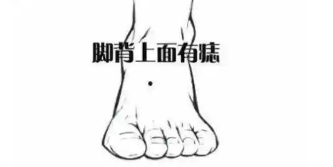 男性脚背长痣代表什么？